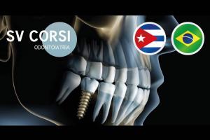 SV Corsi Implantologia